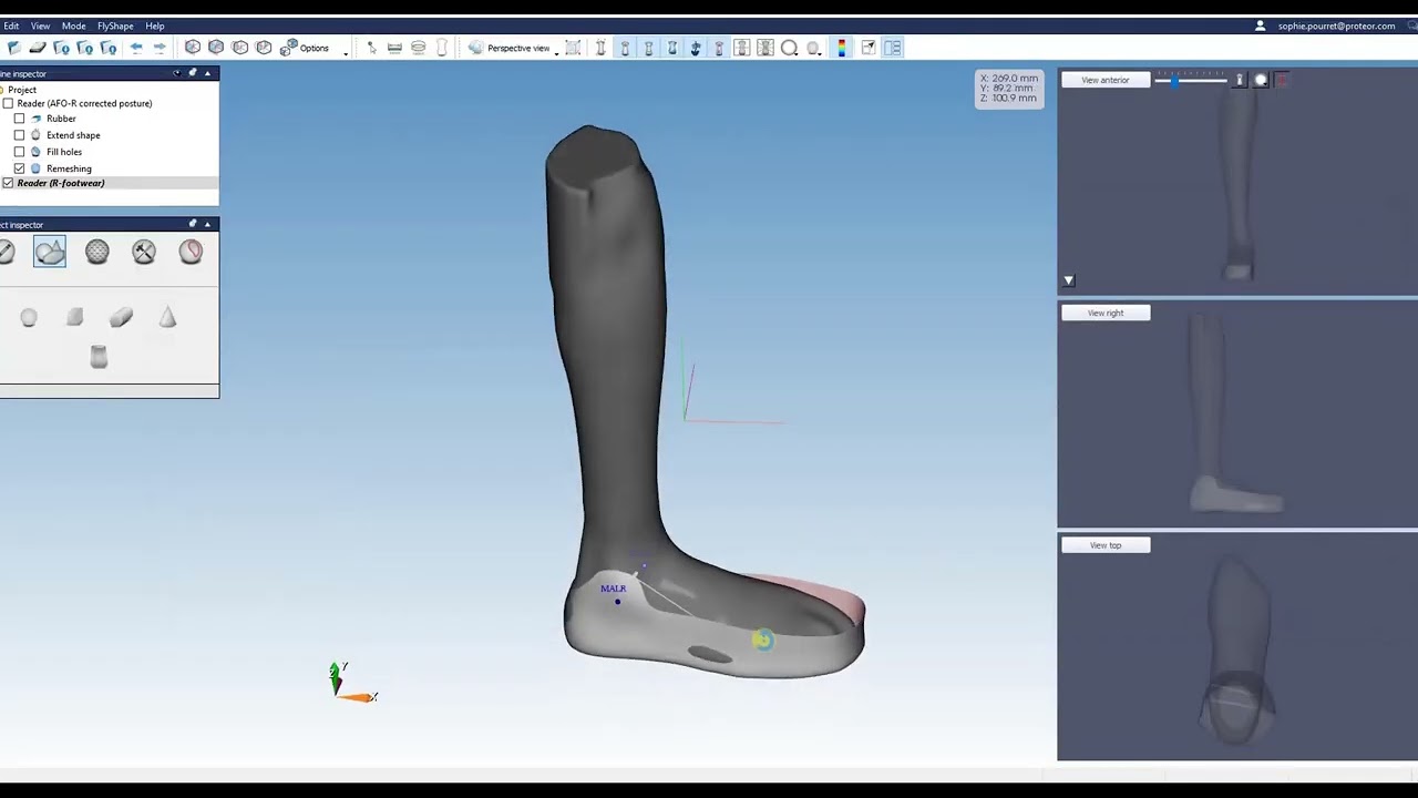 OrtenShape - AFO design