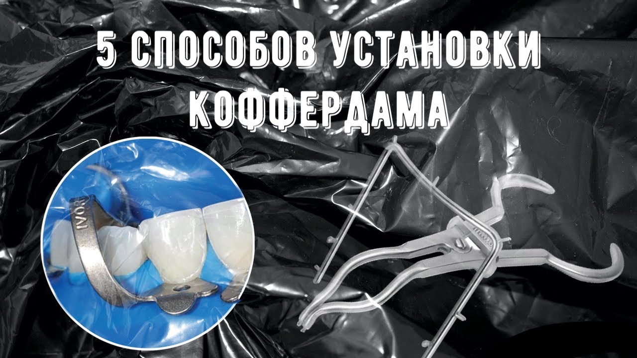 Как установить коффердам (5 способов установки)