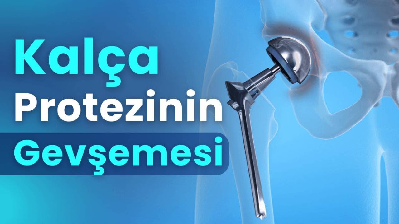 Kalça Protezinde Gevşemenin Nedenleri, Belirtileri ve Tedavi Yöntemleri | Prof. Dr. Yakup YILDIRIM