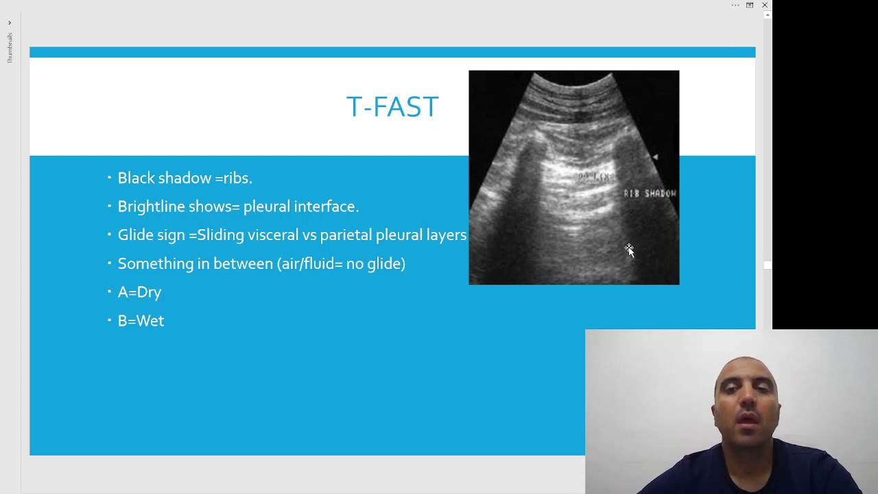 Emergency Ultrasound. T-FAST 2/3. ألتراسوند الطواريء حيوانات أليفة الجزء الثاني من تلاتة طوارئ