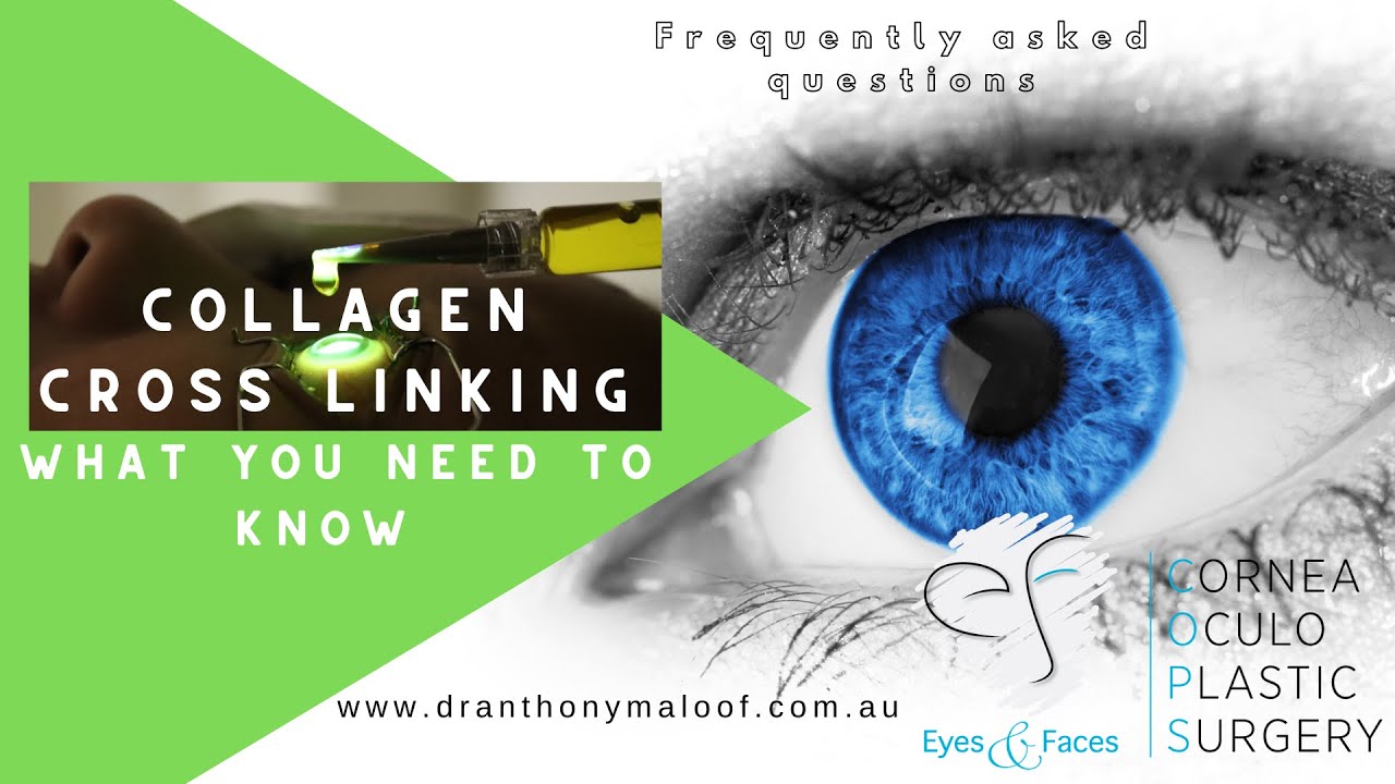 FAQ Collagen Cross Linking - What you need to know - Keratoconus - Dr Anthony Maloof, Sydney AU