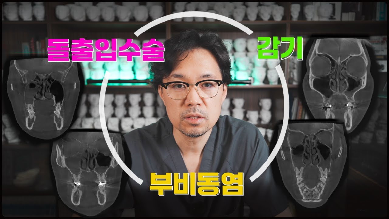 돌출입수술과 부비동염, 그리고 감기....