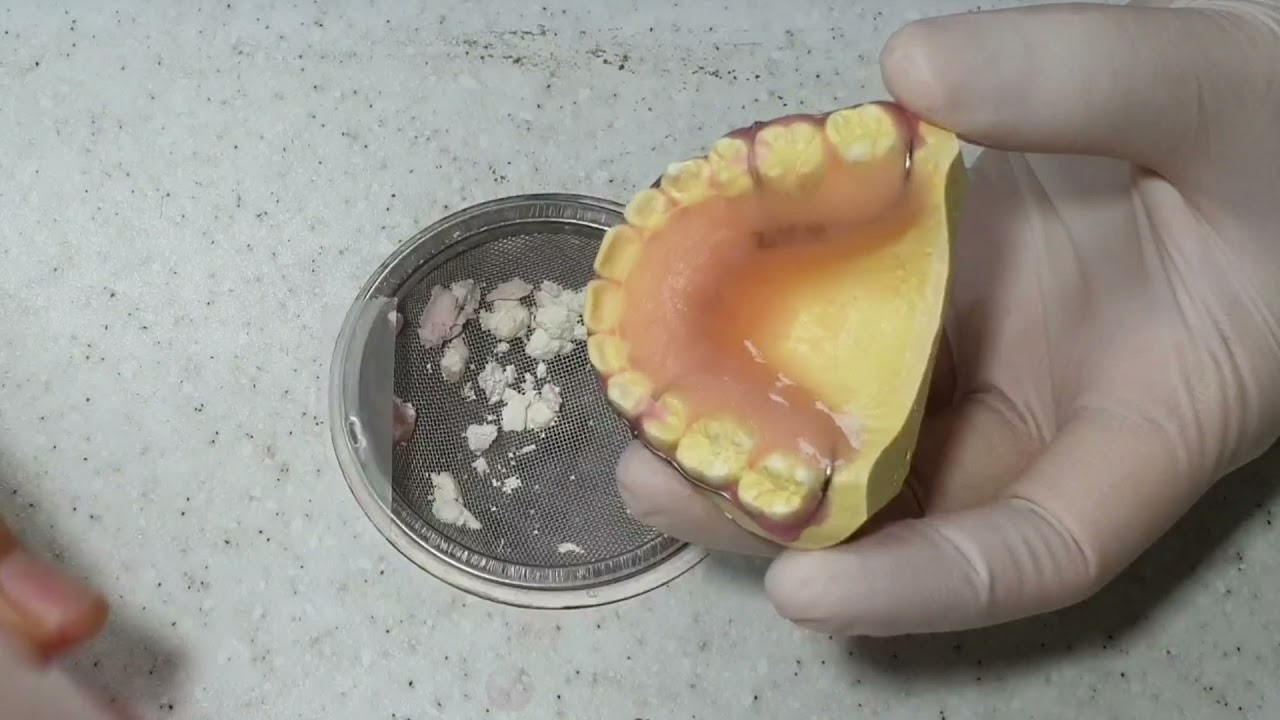 Wraparound retainer resin pouring /Dentarum liquid and powder/orthodontic appliance
