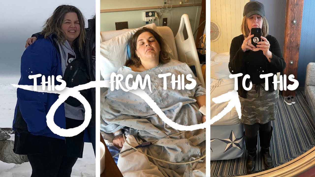 33 Lessons Learned: Wish I Knew Before WLS/Living the Post Bariatric Life.