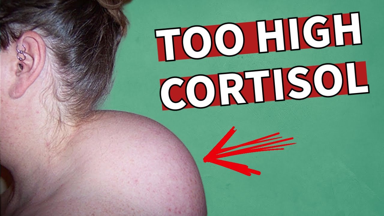 9 Signs You Have HIGH Cortisol
