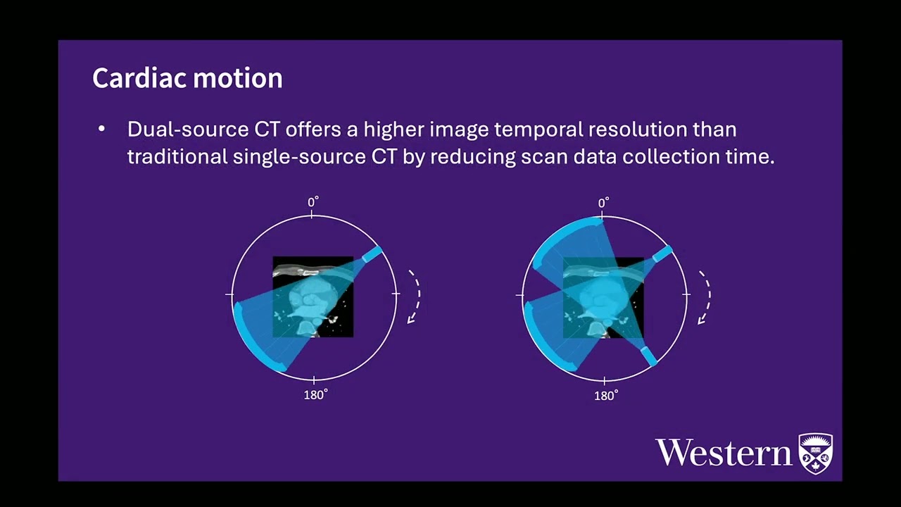 Sponsored symposium: Cardiac stress CT perfusion - unlocking insights thanks Revolution™ Apex