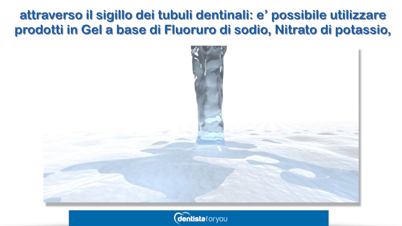La sensibilità dentale, Cause e Soluzioni