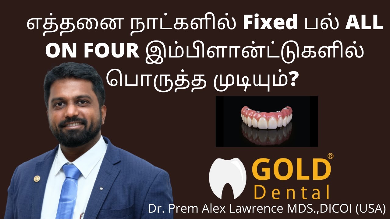 எத்தனை நாட்களில் Fixed பல் ALL ON FOUR இம்பிளான்ட்டுகளில் பொருத்தலாம்? | Dr Prem answers in Tamil