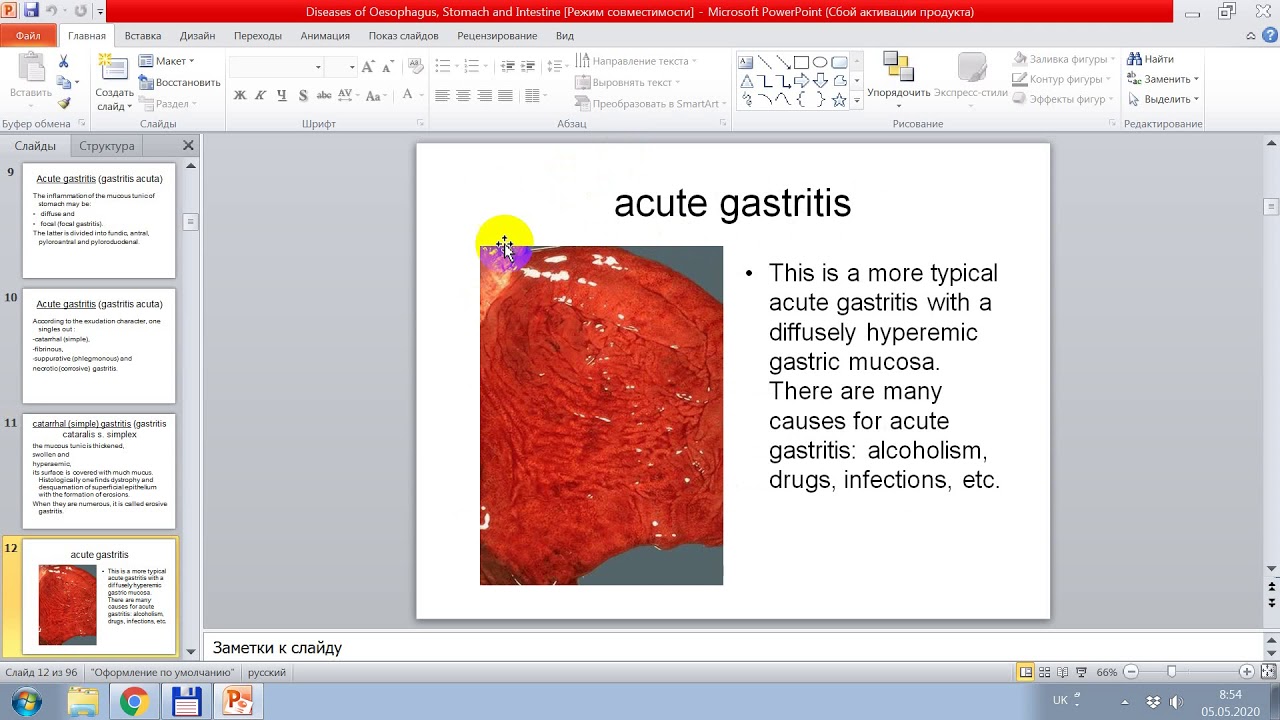 Digestive system pathology by prof. A. Romaniuk