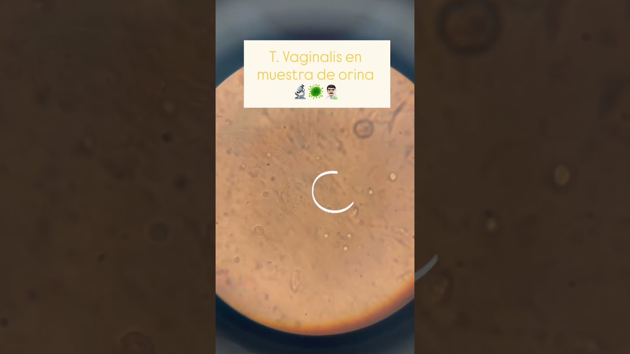trichomonas vaginalis en muestra de orina 🦠🧪 #labclinico #laboratorio #microbiolog&iacute;a #parasite