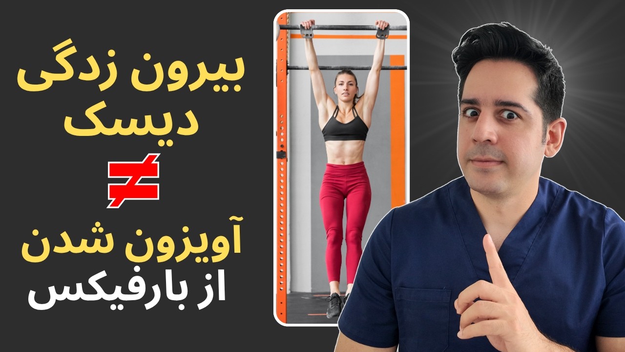 ۲ نوع بیرون زدگی دیسک کمر که باید قبل درمان بدونی