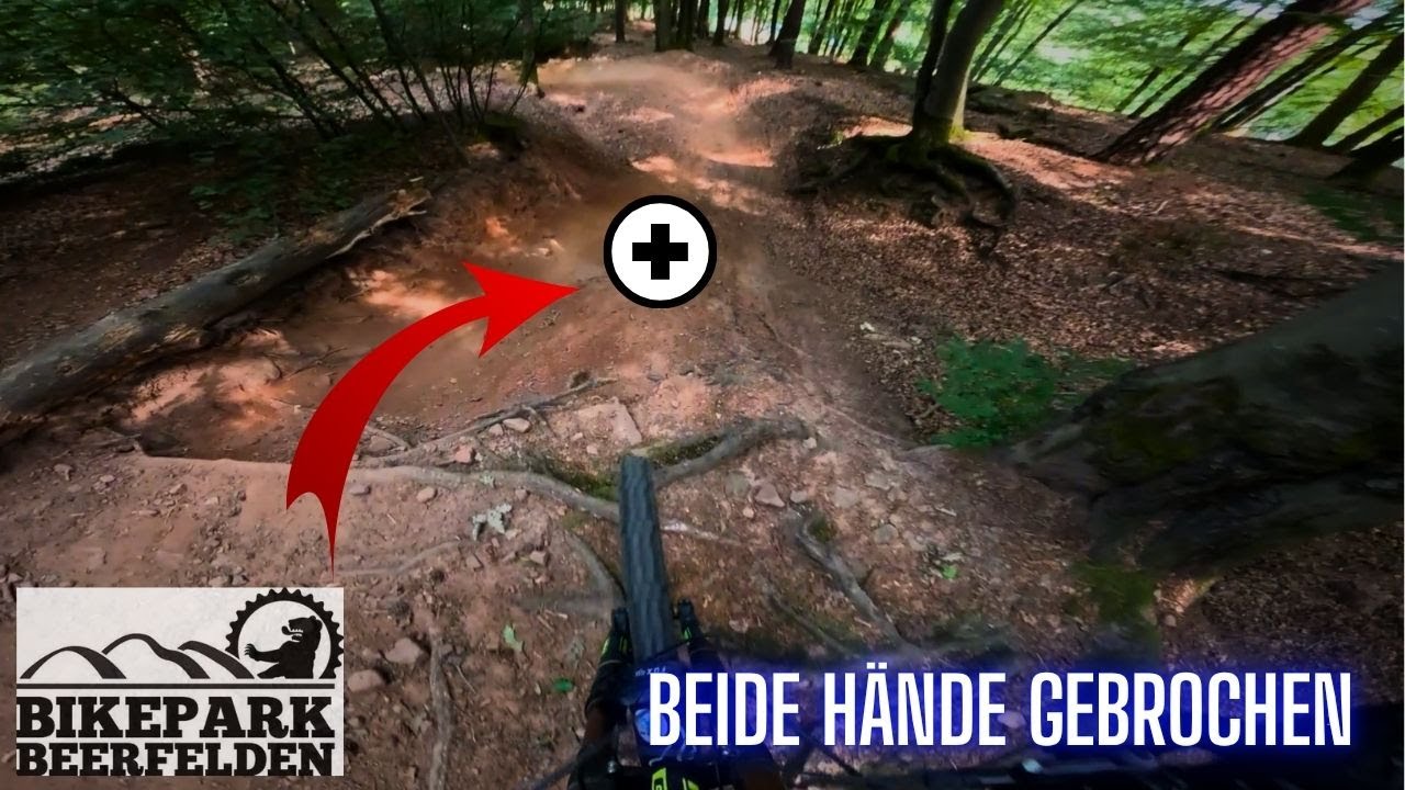 Beide Hände gebrochen / Bikepark Beerfelden / Juli 2025