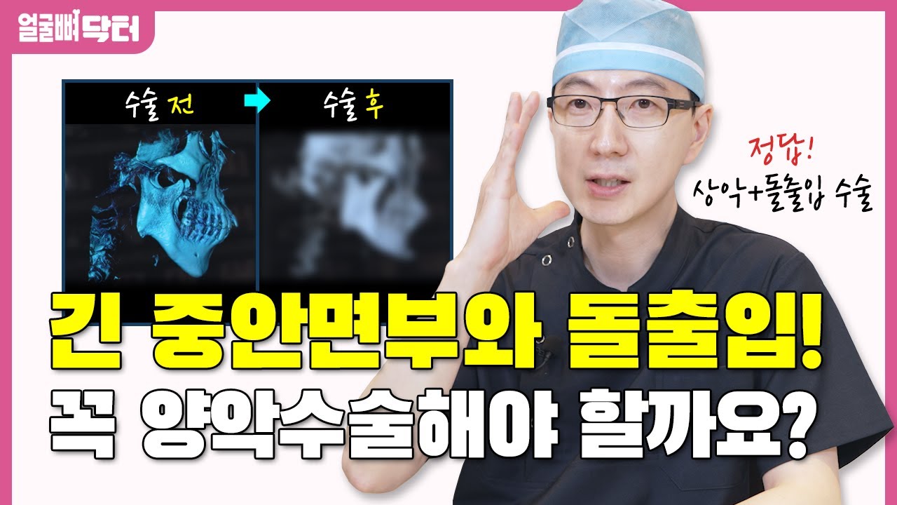 긴 중안면부와 돌출입! 꼭 양악 수술해야 할까요?
