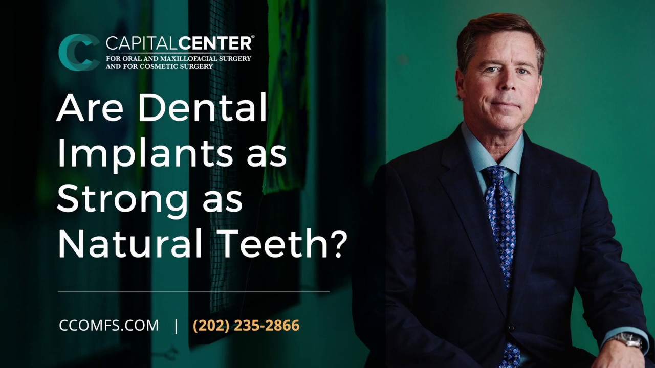 Are Dental Implants as Strong as Natural Teeth? | CCOMFS | Washington, DC