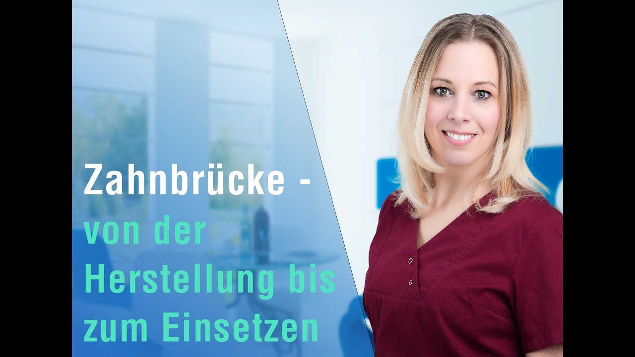 Zahnbrücke ➜ Ablauf, Reinigung & alles, was Du wissen solltest