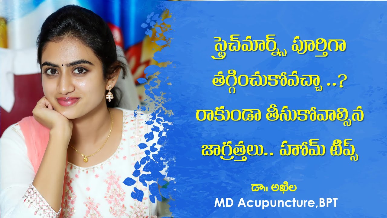 స్ట్రెచ్ మార్న్స్ పోవాలంటే | Stretch Marks Treatment  Telugu |  Causes | Dr. Akhila | Sunrise Tv