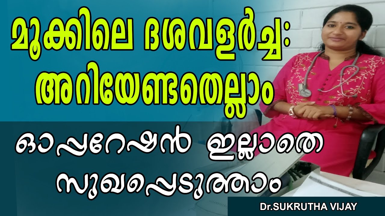മൂക്കിലെ ദശവളര്‍ച്ച: അറിയേണ്ടതെല്ലാം | Nasal Polyps treatment | health tips