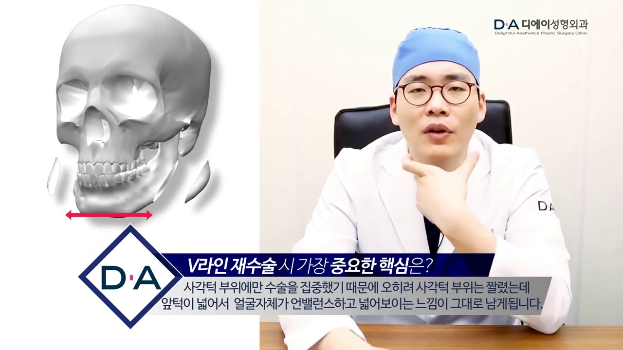 [Korea Facial Contouring] The most crucial point for revision V-line surgery | Dr. Lee Sang Woo