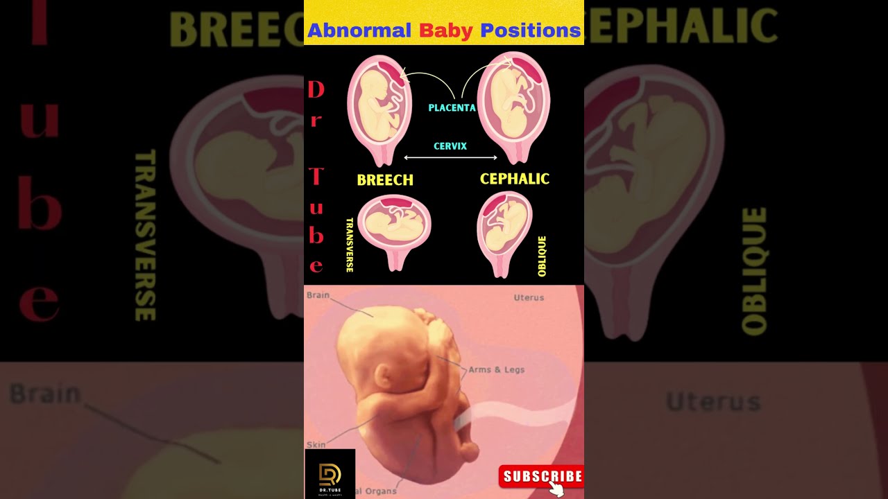 ❤️❤️Understanding Abnormal Baby Positions - Pregnancy positions - Baby position in womb #shortsfeed