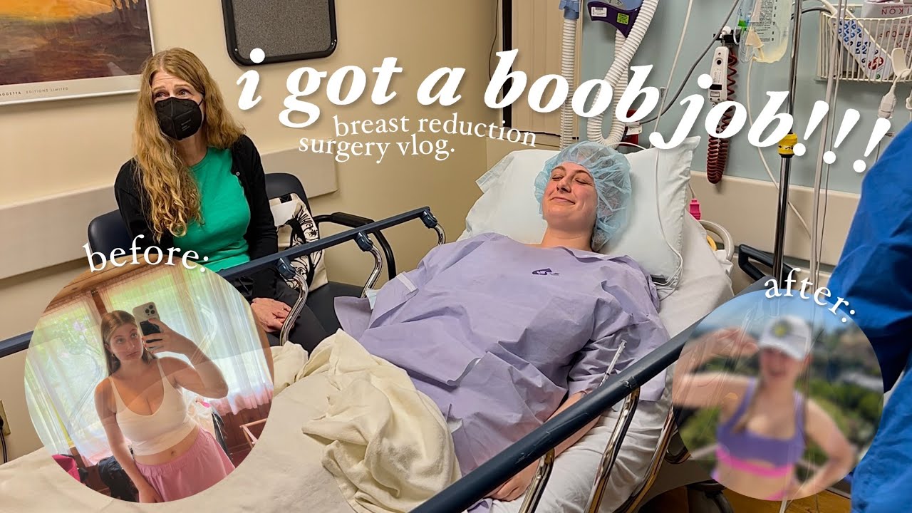 I GOT A BREAST REDUCTION (surgery vlog + honest opinions)