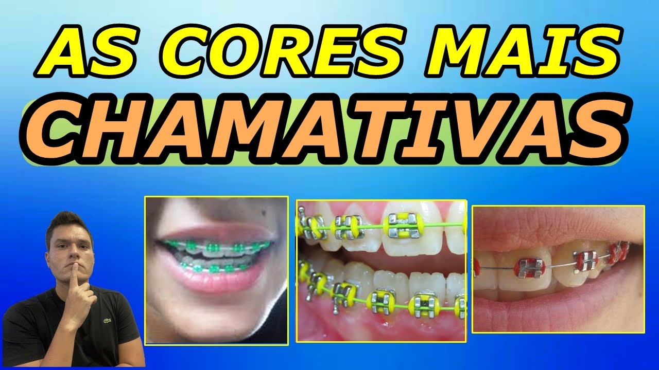 TOP 10 CORES MAIS CHAMATIVAS PARA BORRACHINHAS DO APARELHO ORTODÔNTICO | CORES MAIS DESTACADAS!!!