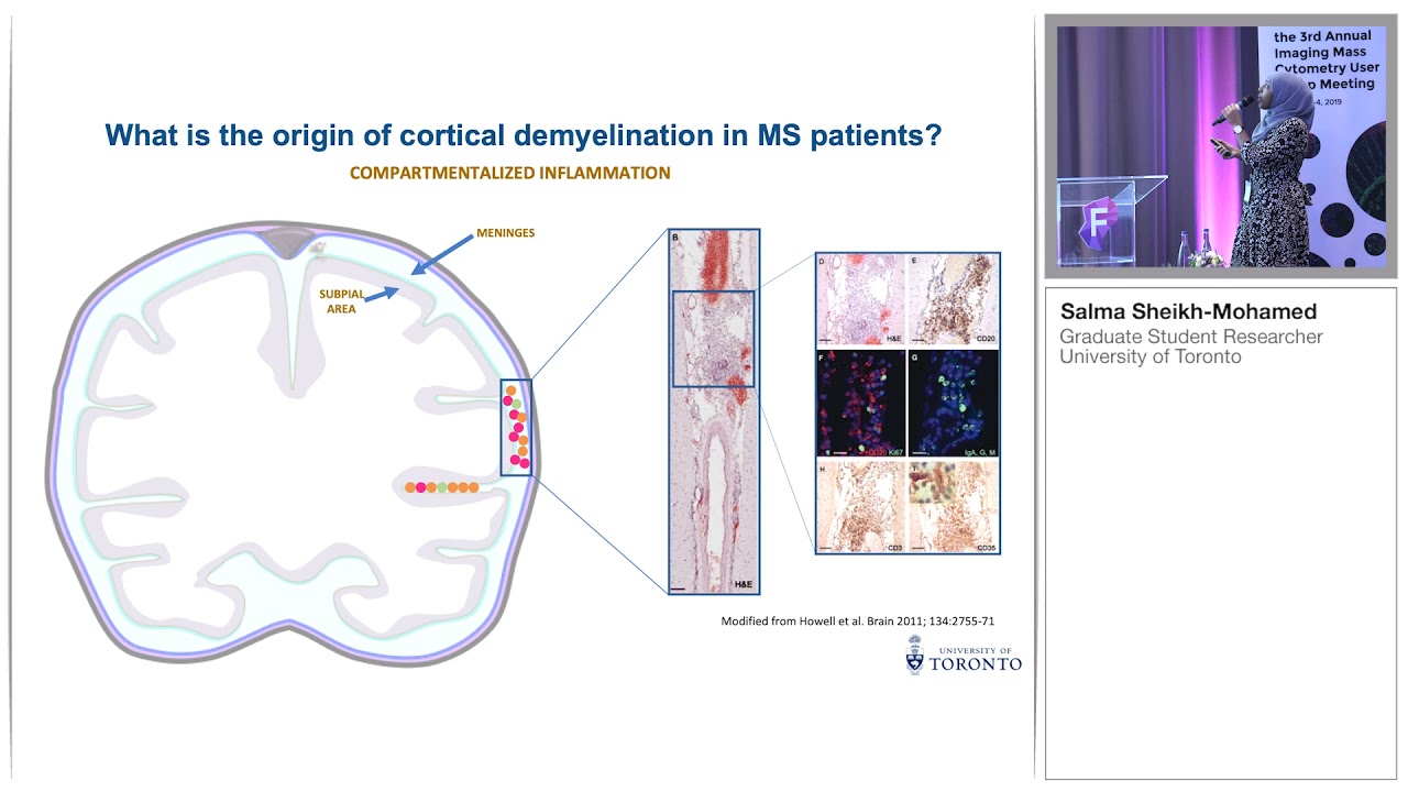 Multiplex imaging of immune cells in the Multiple Sclerosis brain - Salma Sheikh-Mohamed
