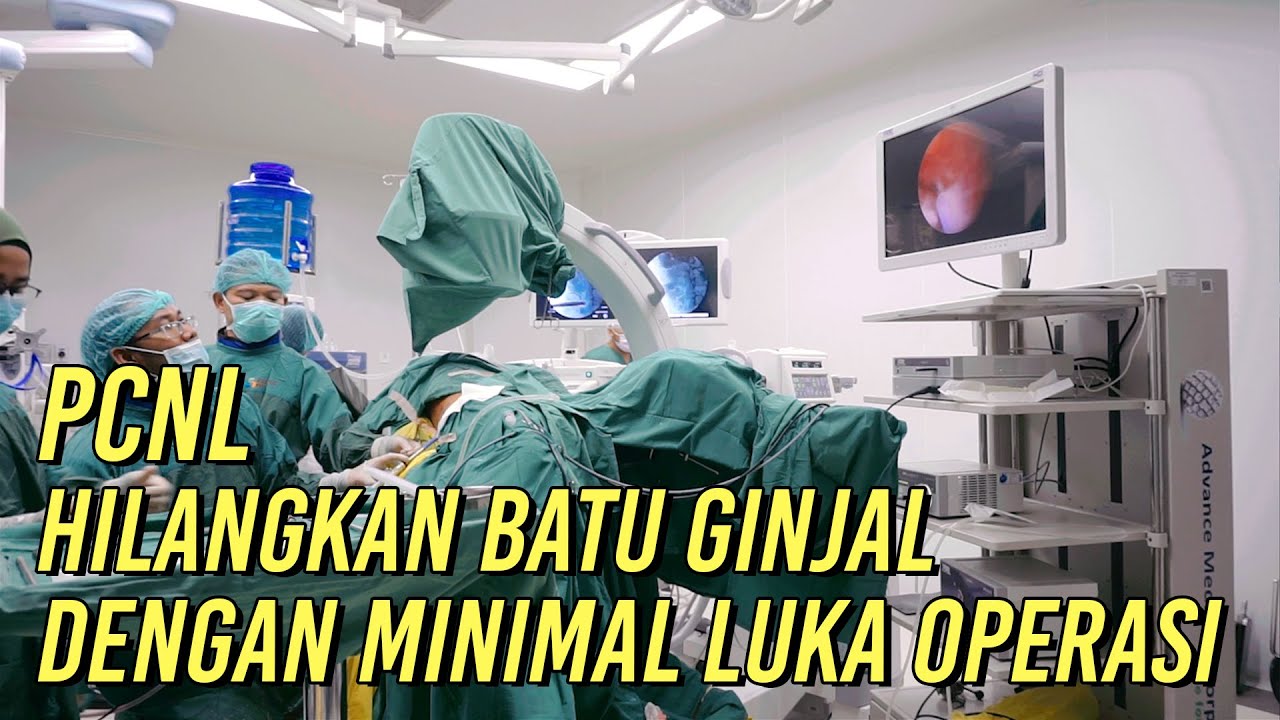 PCNL, Hilangkan Batu Ginjal dengan Minimal Luka Operasi | RSUD Simpang Lima Gumul Kediri