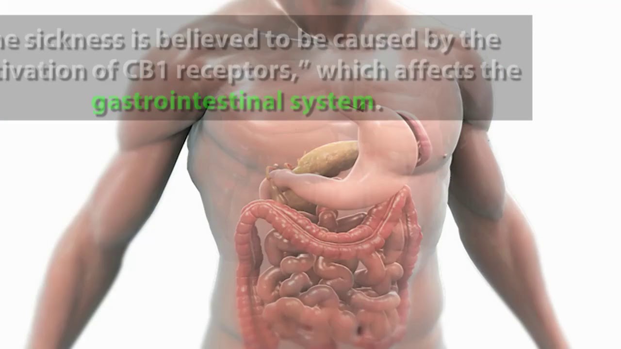 What You Need to Know  Cannabinoid Hyperemesis Syndrome