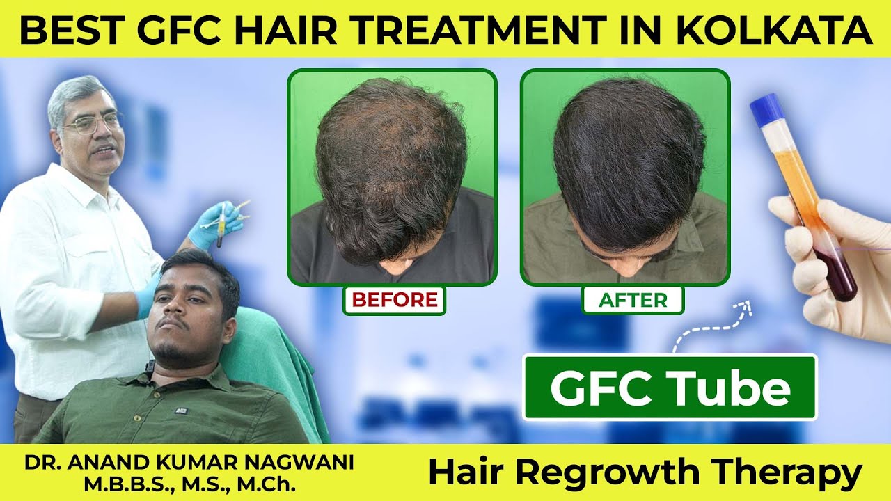 Best GFC Hair Treatment in Kolkata | Dr. Nagwani Explains GFC Therapy | Hair Regrowth Therapy