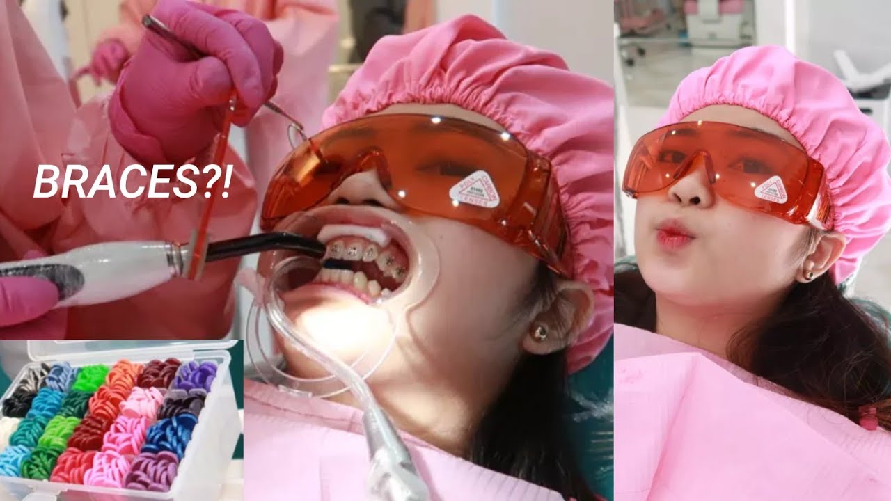 I GOT BRACES! | Camille Romero