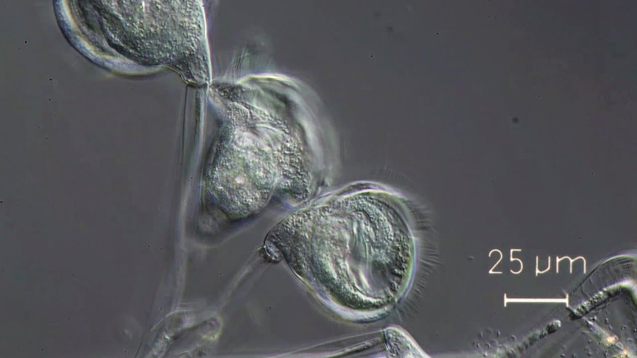 Carchesium sp., a peritrichous protozoan.