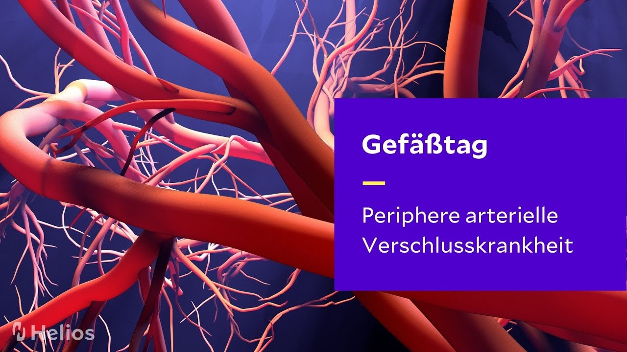 Gef&auml;&szlig;tag 2021 - Periphere arterielle Verschlusskrankheit