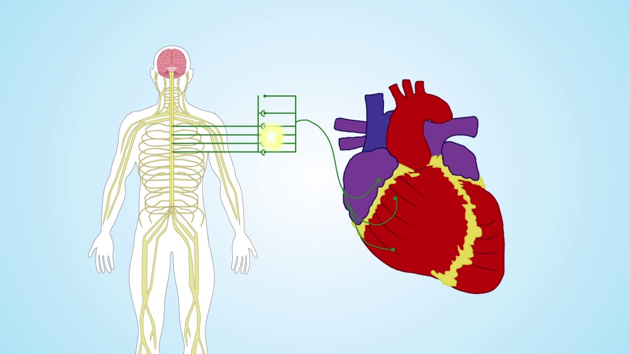 Video Abstract: Be Still My Beating Heart