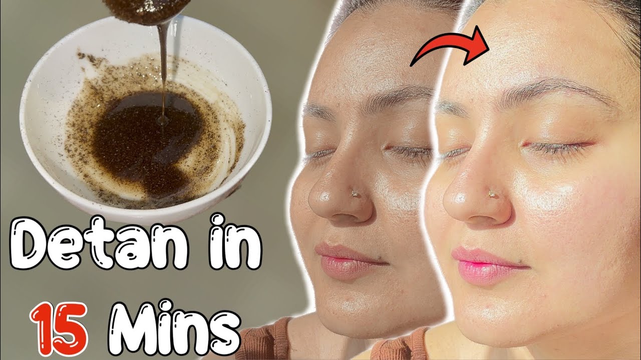Remove Sun-Tan Instantly : ये Remedy जिद्दी से जिद्दी Sun Tan को 15 मिनट में गायब कर देगी💕