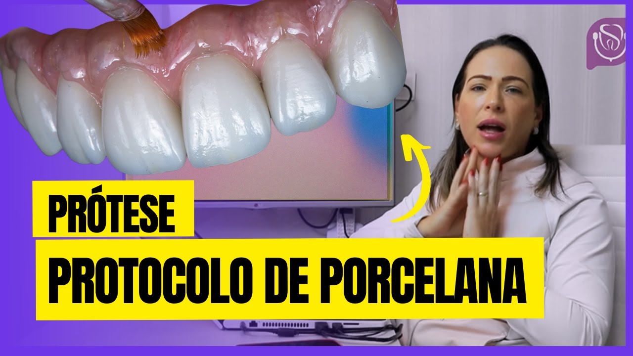 Prótese Protocolo de Porcelana - Clínica Dental Santé