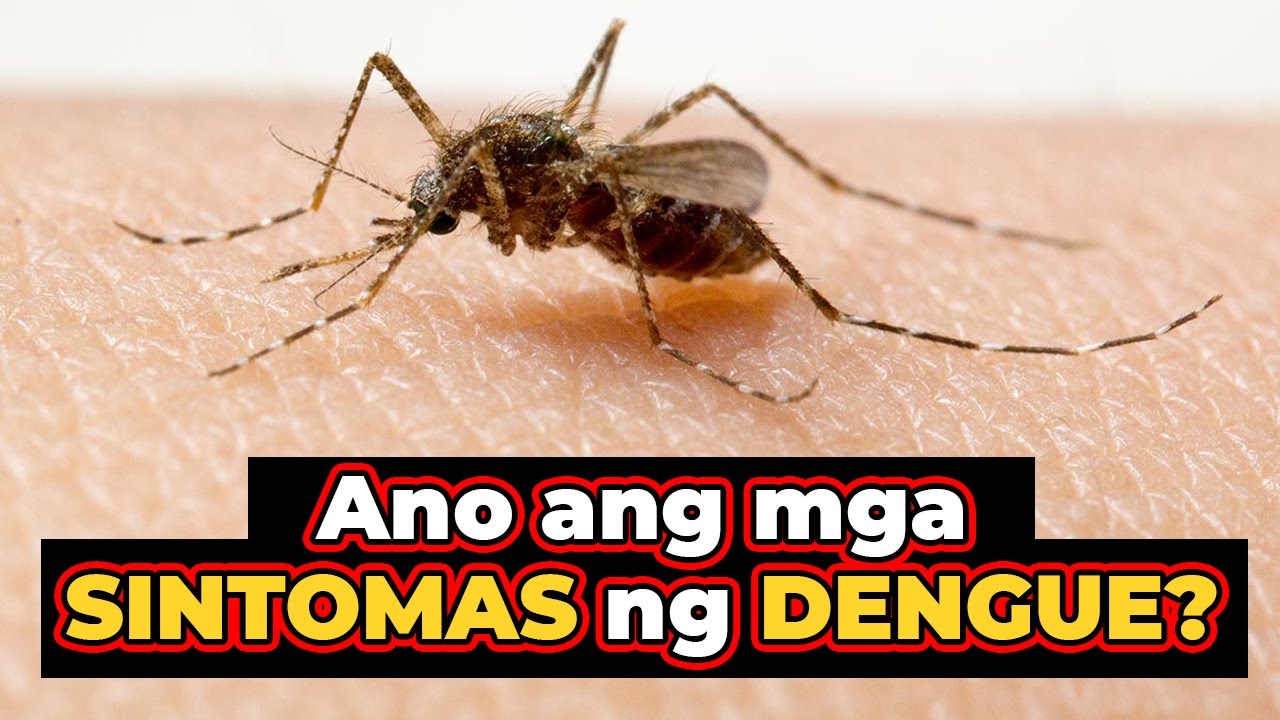 Ang ang mga Sintomas ng Dengue | Sagot Ka Ni Dok