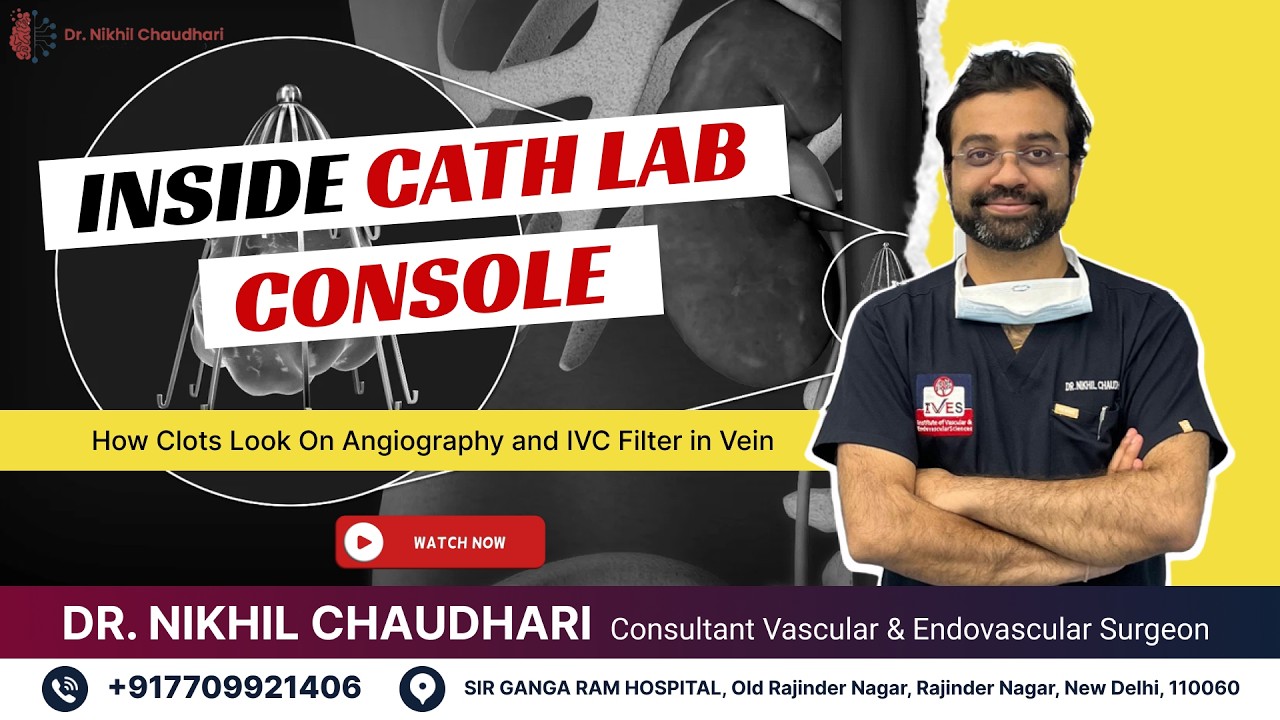 Inside Cath Lab Console : How Clots Look On Angiography and IVC Filter in Vein