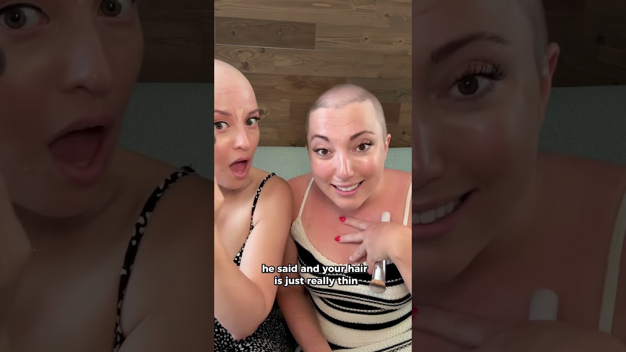 Dating & Hair Loss Part 2 ❤️ #alopecia #dating #advice #hairloss #confidence
