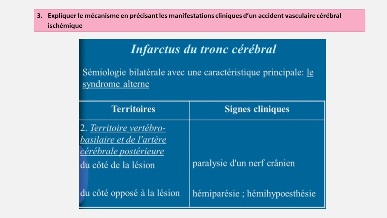 UE 2.8 Processus obstructifs- Questionnaire de révisions : AVCI