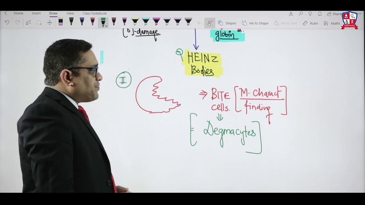 Topic : G6PD Defeciency Anemia By Dr Devesh Mishra