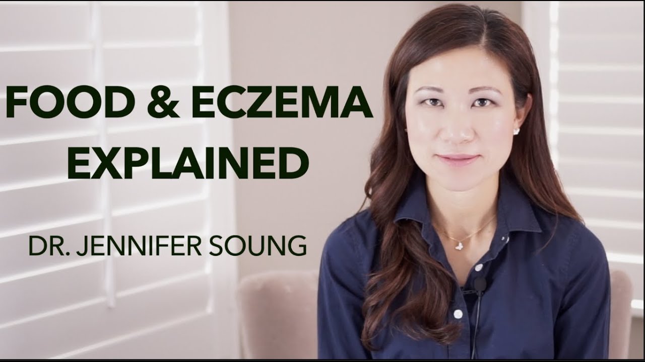 The Relationship Between Food and Eczema Explained