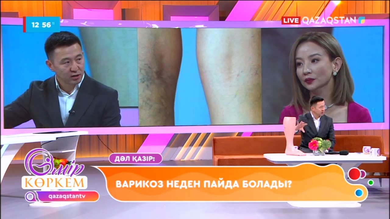 Варикоз неден пайда болады? І Өмір көркем