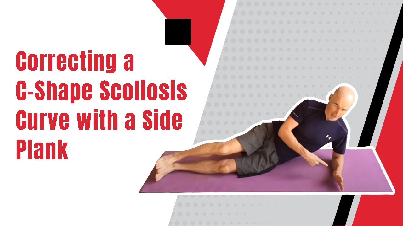 Correcting a C-Shape Scoliosis Curve with a Side Plank