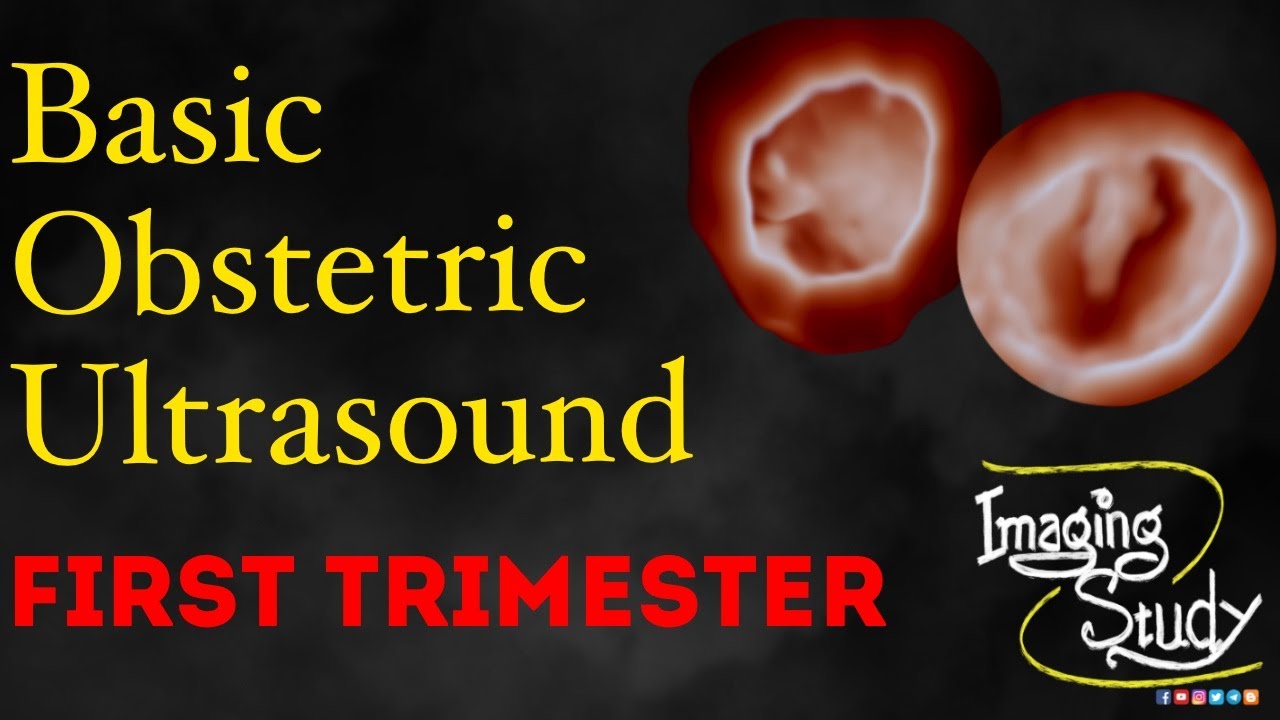 Basic Obstetric Ultrasound: First Trimester Pregnancy