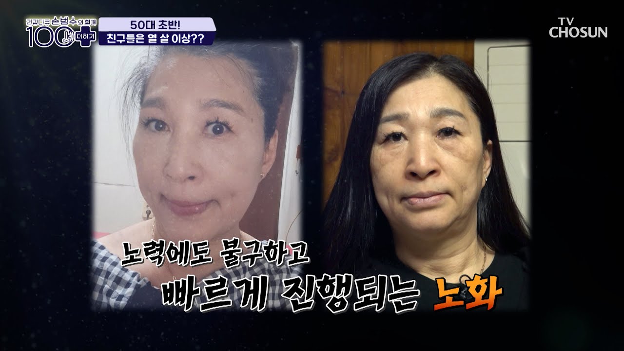 노안에 사로잡힌 삶😥 노화의 원인은 콜라겐 부족? TV CHOSUN 240309 방송 | [손범수와 함께 100세 더하기] 1회 | TV조선