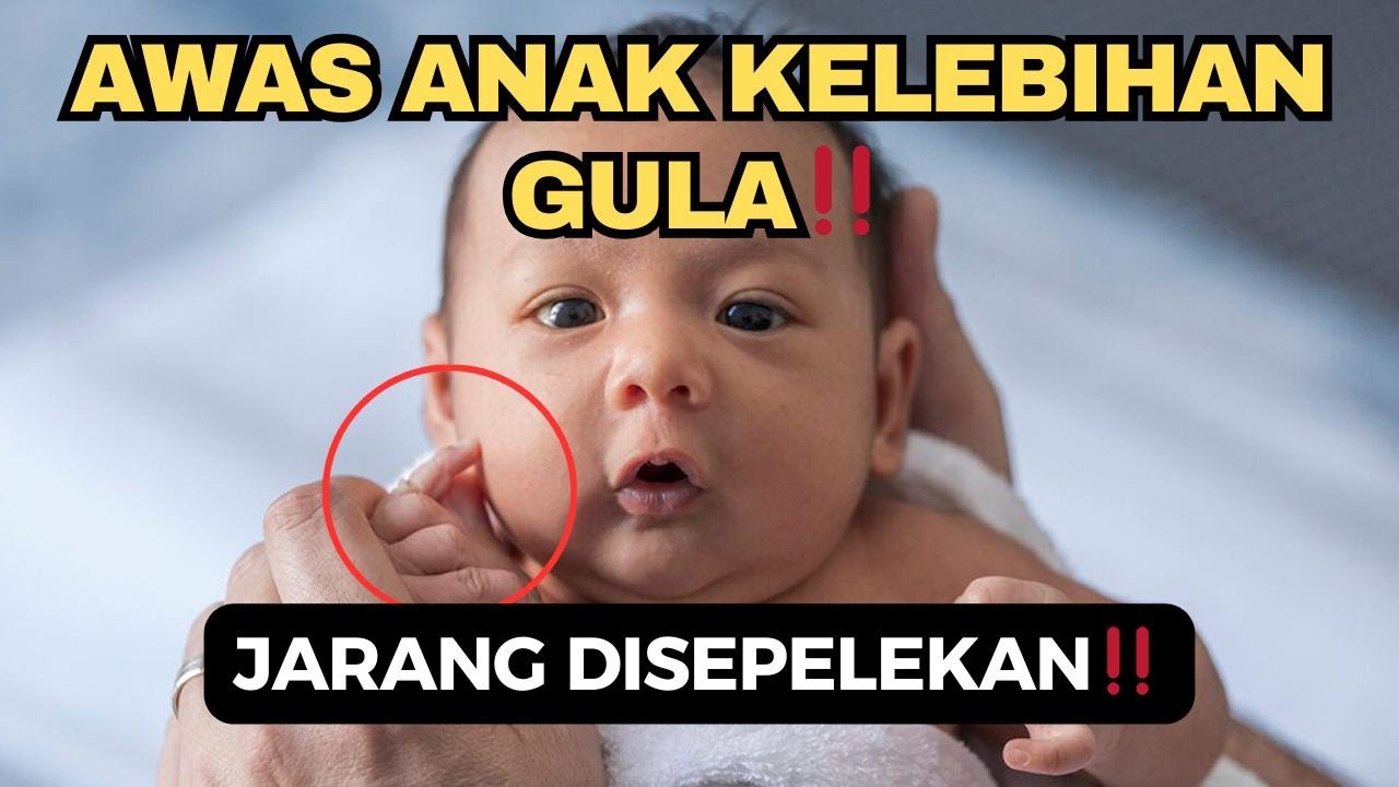 TANDA ANAK KELEBIHAN GULA‼️WASPADAI INI..
