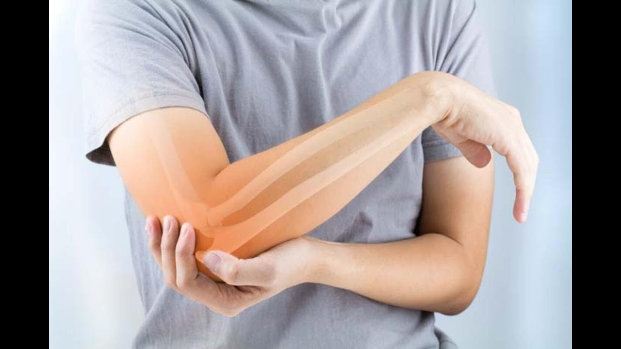 DİRSEKTE SİNİR SIKIŞMASI, KÜBİTAL OLUK SENDROMU, EL UYUŞMASI, ULNAR SİNİR HASARI