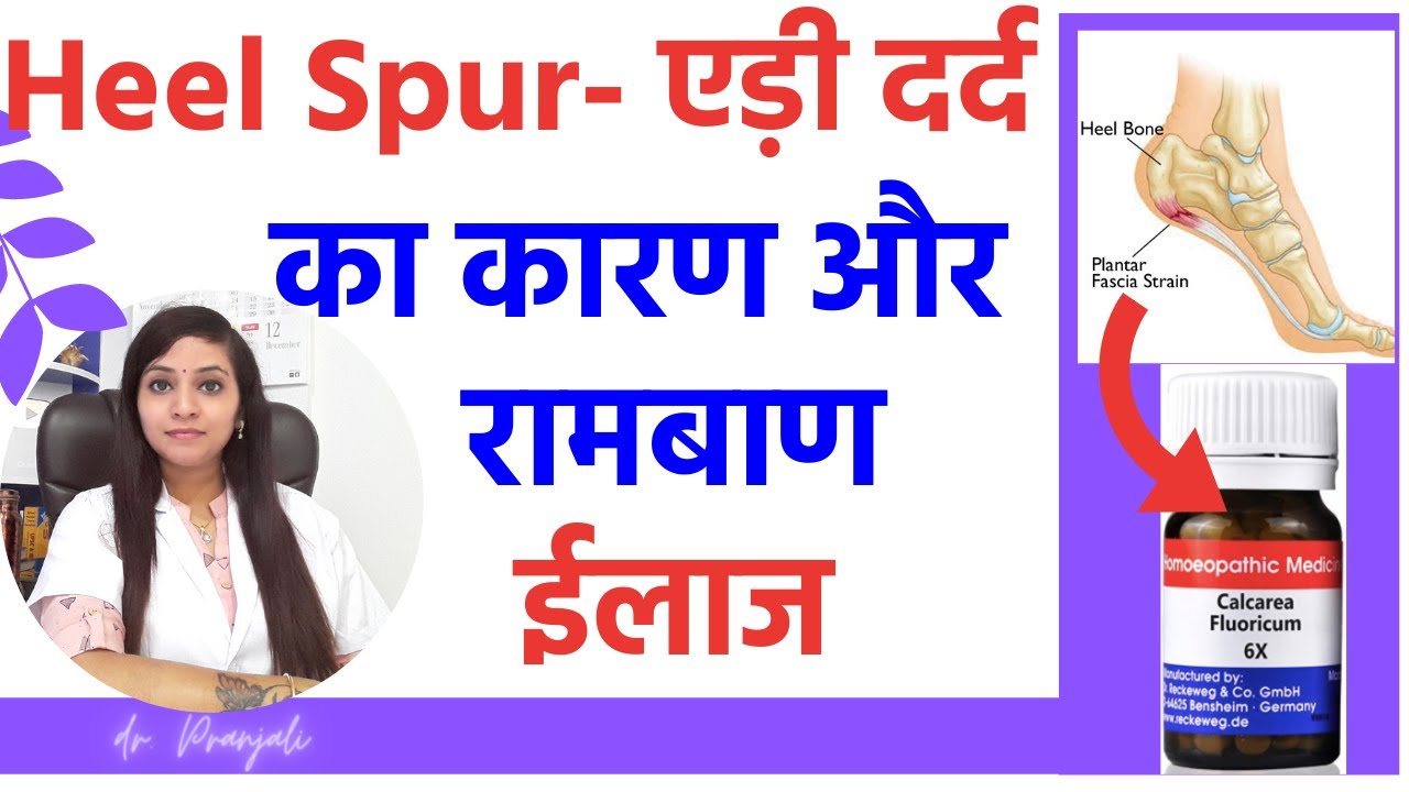 एड़ी दर्द का इलाज | heel spur homeopathic treatment | edi dard ki dawa | heel spur treatment in hindi