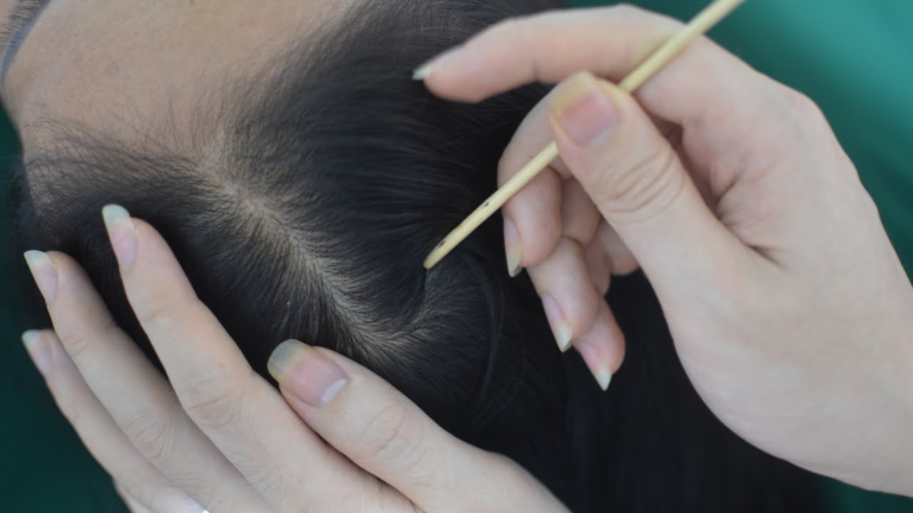 ASMR Real Person Hair Hlay, Hair Parting, Scalp Scratching Tingly For Headache Relief ( No Talking )
