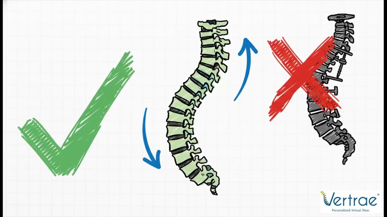 Minimally Invasive Surgery for Spinal Stenosis: What You Need to Know | Dr. Kamal Woods | Vertrae&reg;